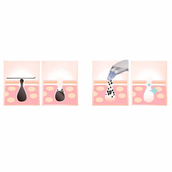 میکرودرم گلویش استایل مدل JL-808